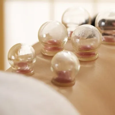 Cupping Therapy